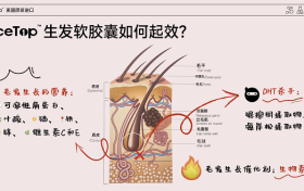 NiceTop所先养发胶囊双管齐下 从根源解决脱发难题